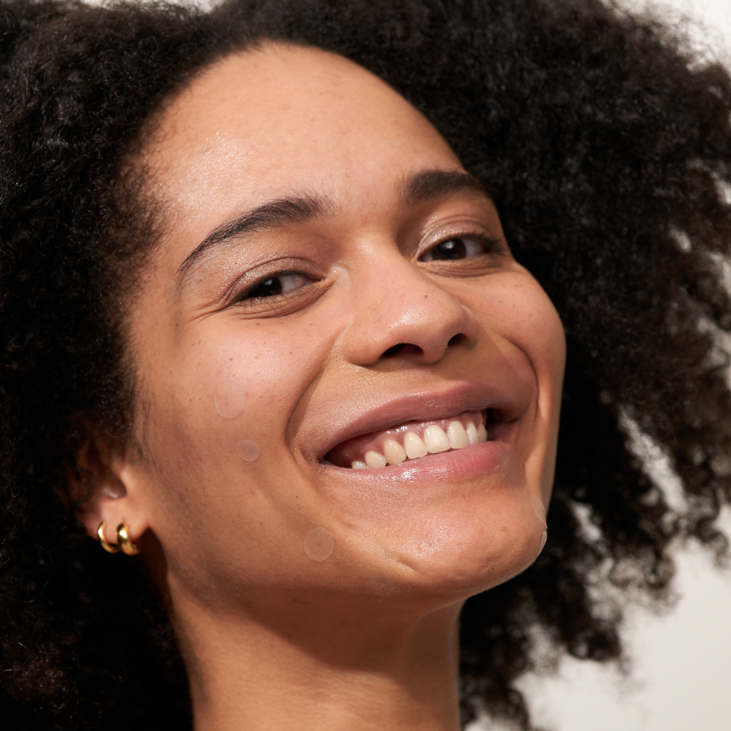 APRICOT Post-Pimple Patches – Tegen Donkere Vlekken & Roodheid