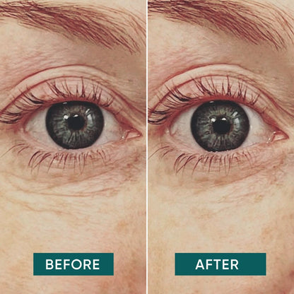 APRICOT Herbruikbare oogmaskers met Vitamine C