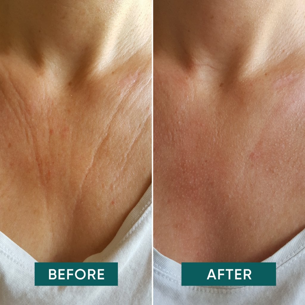 APRICOT Decolleté Pad met Hyaluron