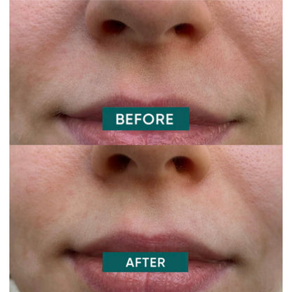 APRICOT Katoenen mondpleisters met Niacinamide