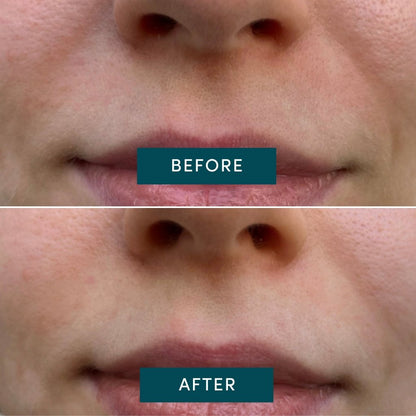 APRICOT Cotton Mouth Patches with Panthenol