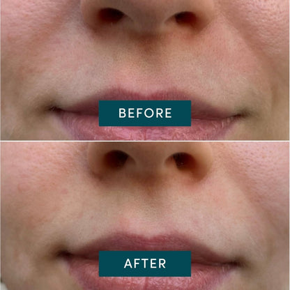 APRICOT Cotton Mouth Patches with Niacinamide - Mini Pack