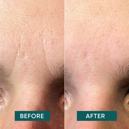 APRICOT Cotton Facial Patches with Aloe Vera