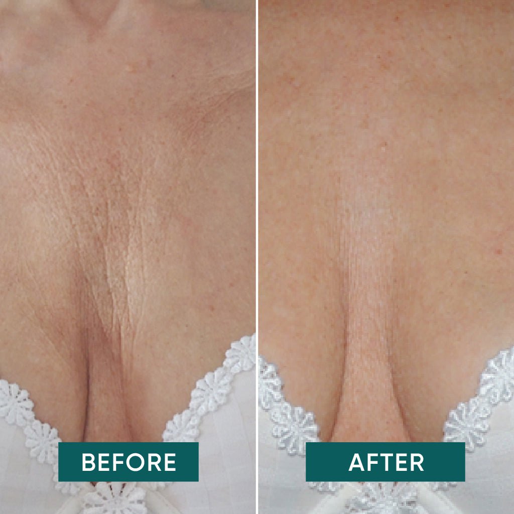 APRICOT Reusable Décolleté Pad met Ectoïne - Gladde en stevigere huid