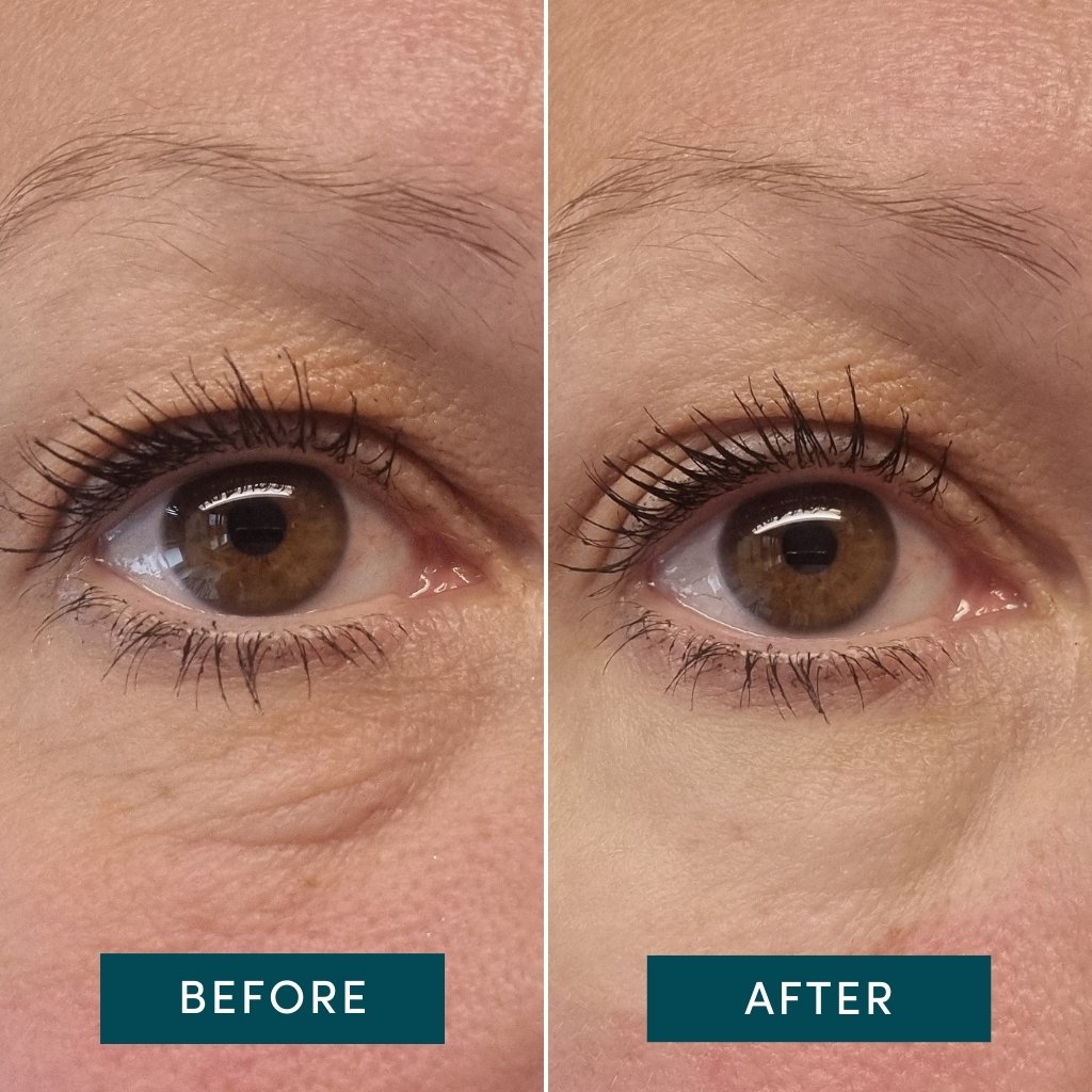 APRICOT Reusable Eye & Temple Pads – Hexapeptide Anti-Aging Technologie